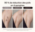 Ulike Air 2 Épilateur IPL-reduction-poils-90-pourcent-4-semaines-SGS