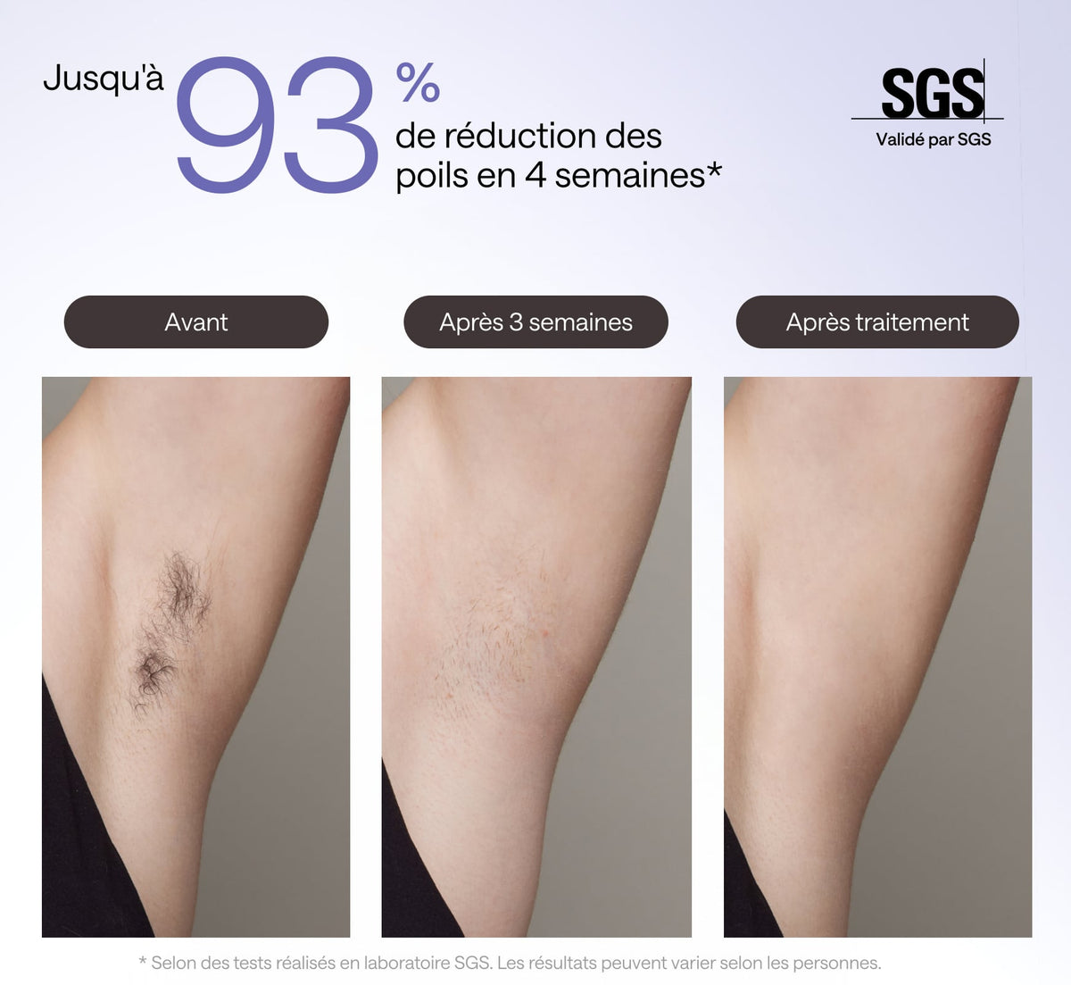 ulike-air3-epilateur-ipl-reduction-poils-93-4-semaines-sgs