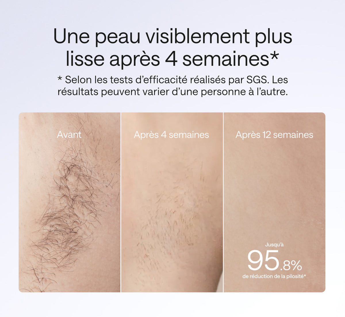 ulike-air4-epilateur-ipl-aisselles-avant-apres-95-8-12-semaines-sgs